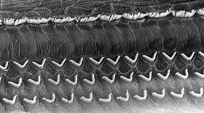 Image des cellules ciliées en microscopie électronique